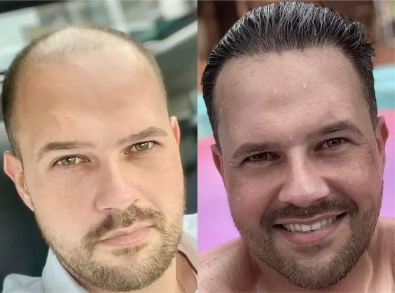 Antes e depois enviado por Guilherme Ferreira